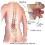 back pain treatment in indore for surgery decision and spine care